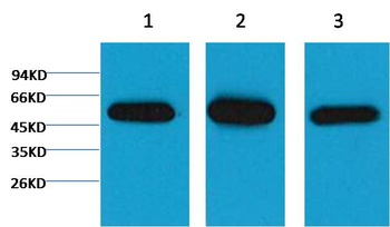 β I tubulin Mouse mAb