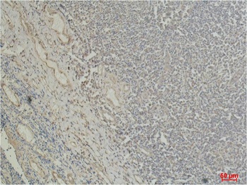β I tubulin Mouse mAb