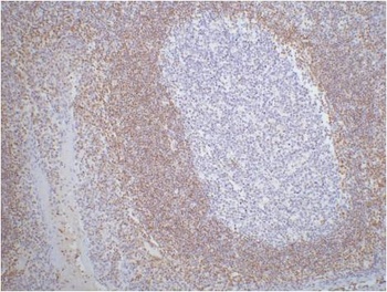 Bcl-2 Mouse mAb