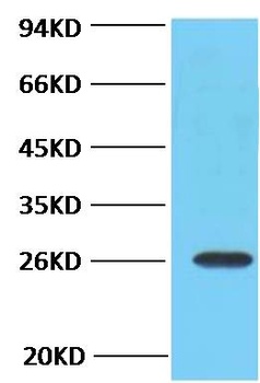 Bcl-2 Mouse mAb
