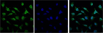 Bcl-2 Mouse mAb