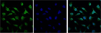 Bcl-2 antibody