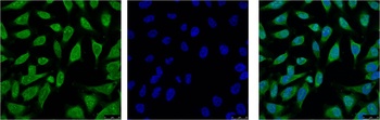 HSP70 Mouse mAb