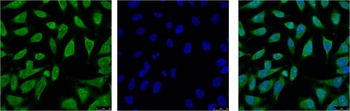 HSP70 antibody