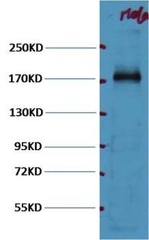 EGFR Mouse mAb