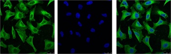 EGFR antibody