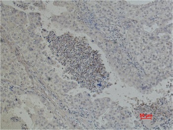 EGFR Mouse mAb
