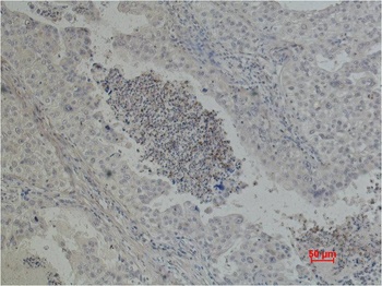 EGFR antibody