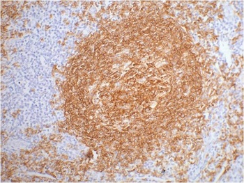 CD20 Mouse mAb Antibody