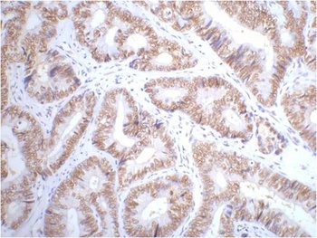 p53 antibody