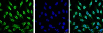 p53 antibody