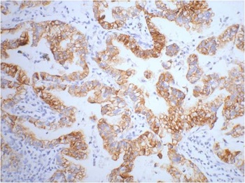 CK7 Mouse mAb