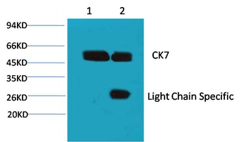 CK7 antibody
