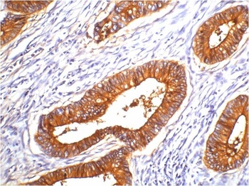 Carcinoembryonic Antigen/CEA Mouse mAb Antibody