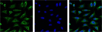 Aquaporin 4 antibody