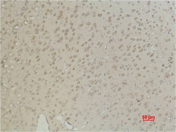 Aquaporin 4 Mouse mAb