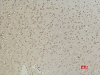 Aquaporin 4 antibody