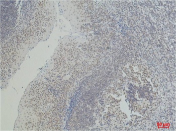 CD2 Mouse mAb Antibody