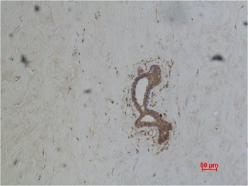 ABCB5 Mouse mAb
