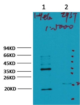 CA IX/Carbonic Anhydrase IX Mouse mAb