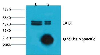 CA IX/Carbonic Anhydrase IX Mouse mAb