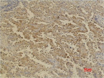 CA IX/Carbonic Anhydrase IX Mouse mAb