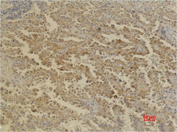 CA IX antibody