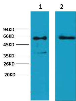 Cytokeratin 6 Mouse mAb Antibody