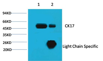 CK17 antibody