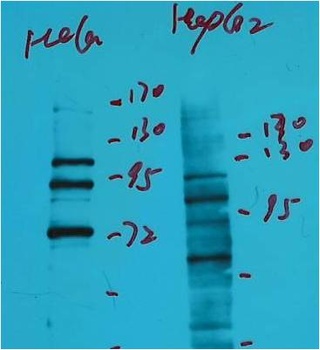 IDE/Insulin Degrading Enzyme Mouse mAb