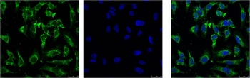 EFHD1 Mouse mAb