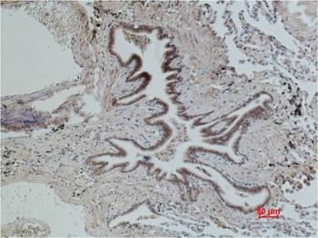 CD16 antibody