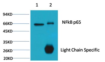 NFkB p65 Mouse mAb