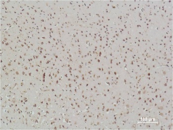 NFkB p65 Mouse mAb