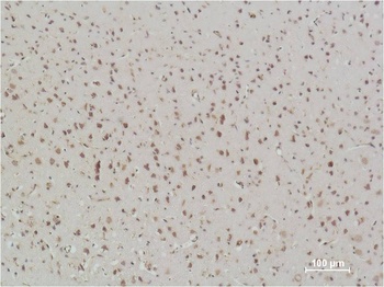 NFkB p65 antibody