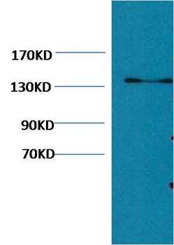 Collagen III Mouse mAb