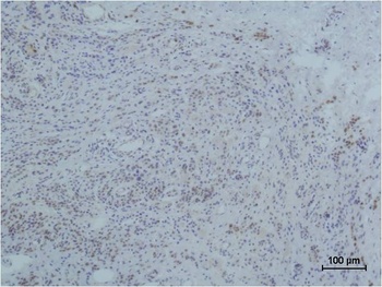 Collagen III Mouse mAb