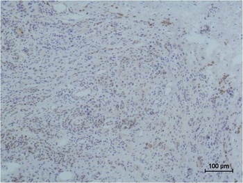 Collagen III antibody