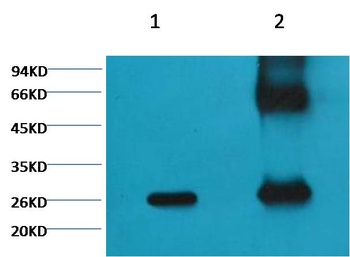 GFP-Tag antibody