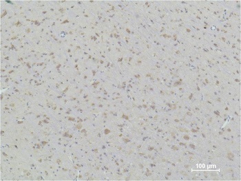 HSP90β Mouse mAb
