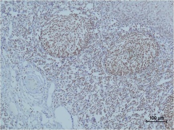 Cleaved PARP Mouse mAb