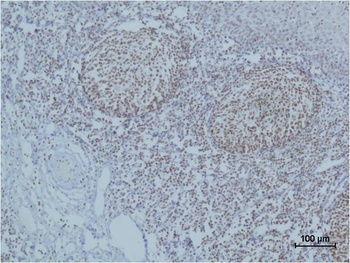 Cleaved PARP antibody