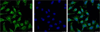 EGFR Mouse mAb