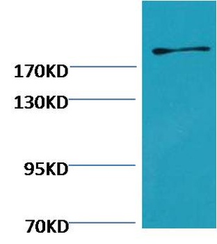 Fibronectin antibody