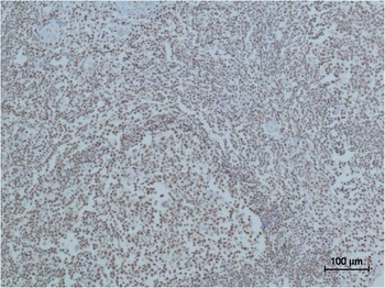 Cleaved PARP Mouse mAb