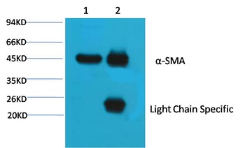 α skeletal muscle actin Mouse mAb