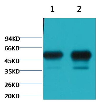β II tubulin Mouse mAb Antibody