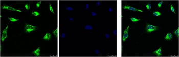 Vimentin Mouse mAb
