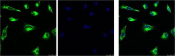 Vimentin antibody