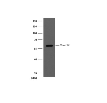 Vimentin Mouse mAb